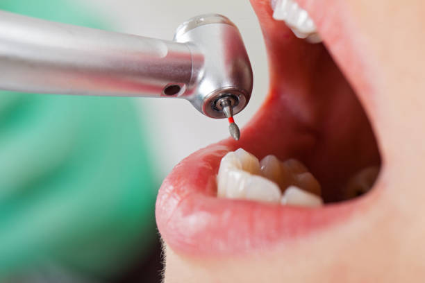 Best Urgent Care for Lost Fillings or Crowns in New Mford, IL